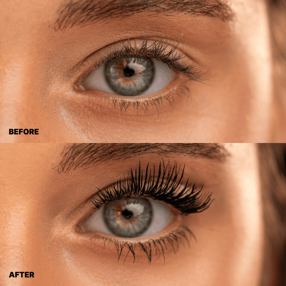 BEFORE-1000x1000-r - J-beauty